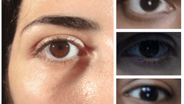 Convolutional Neural Networks for Ocular Smartphone-Based Biometrics